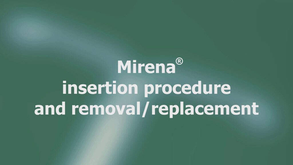 MIRENA® insertion procedure and removal/replacement